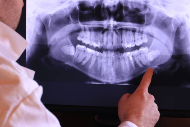 Trusted UT Emergency Dental Service Experts